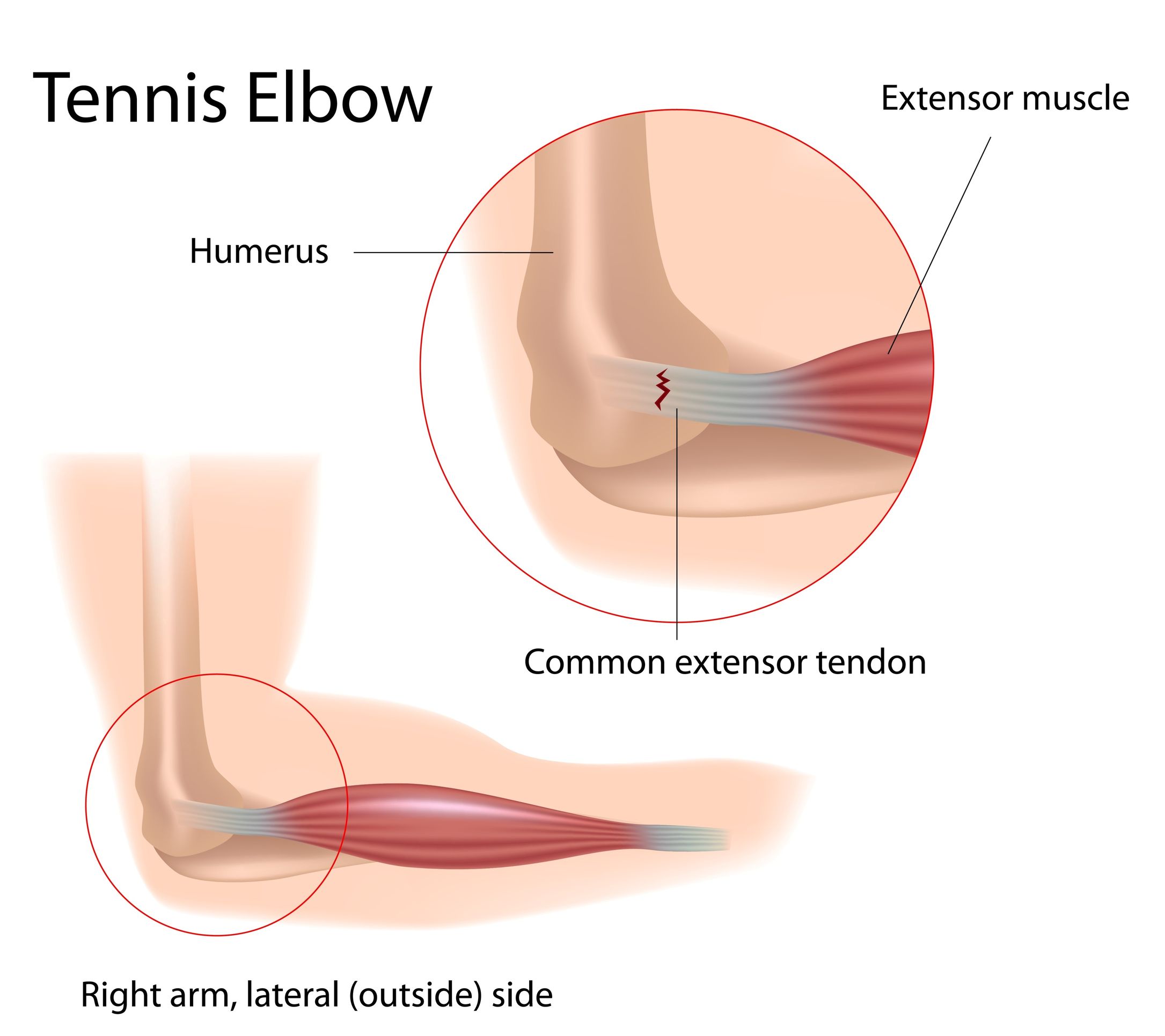 elbow muscle anatomy