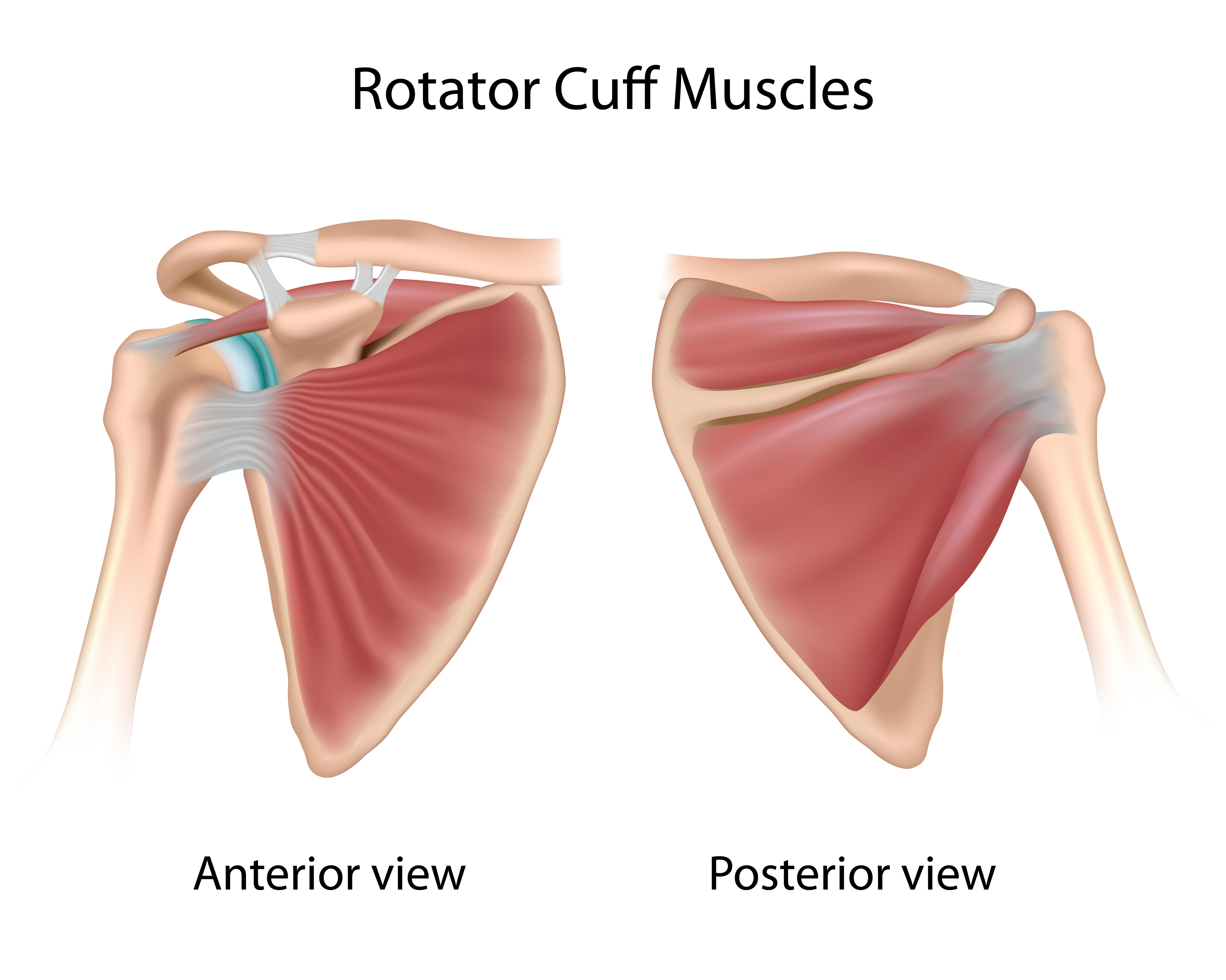 Partial Thickness Rotator Cuff Tears Video Jeffrey H Berg Md