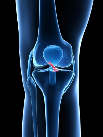 ACL Graft Options