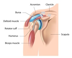 Impingement Syndrome