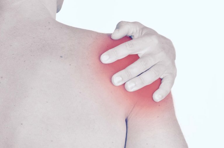 Shoulder Arthritis Symptoms - Jeffrey H. Berg, M.D.